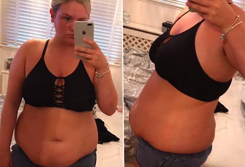Girl Shares Incredible 5 Month Weight Loss Transformation OLIVIA BURGESS 1 image Girl Shares Incredible 5 Month Weight Loss Transformation OLIVIA BURGESS 1